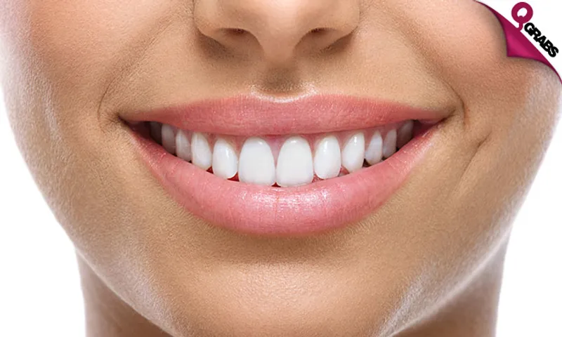 Hollywood Smile Veneers & Dental Implants!